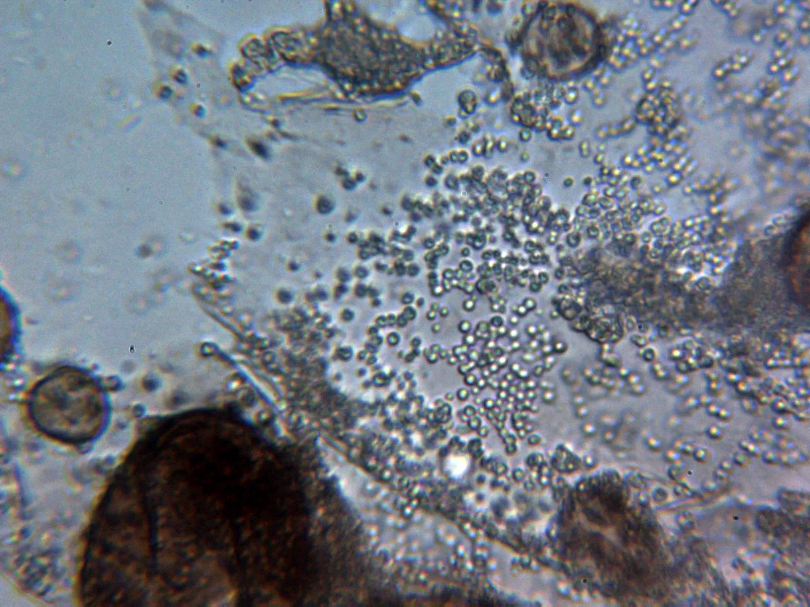 5 - Membrana 1